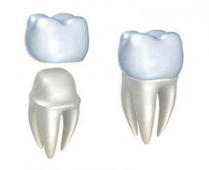 CEREC Dental Crowns In Newport News