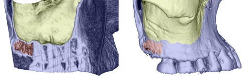 scans